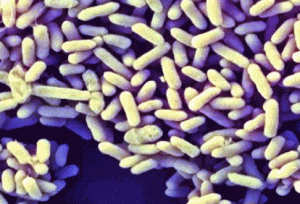 Bifidobacterium Infantis