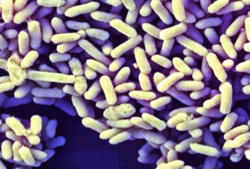 Bifidobacterium-infantis