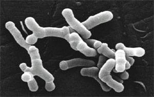 Bifidobacterium Longum