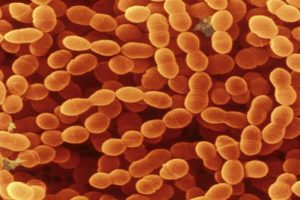 Streptococcus Thermophilus